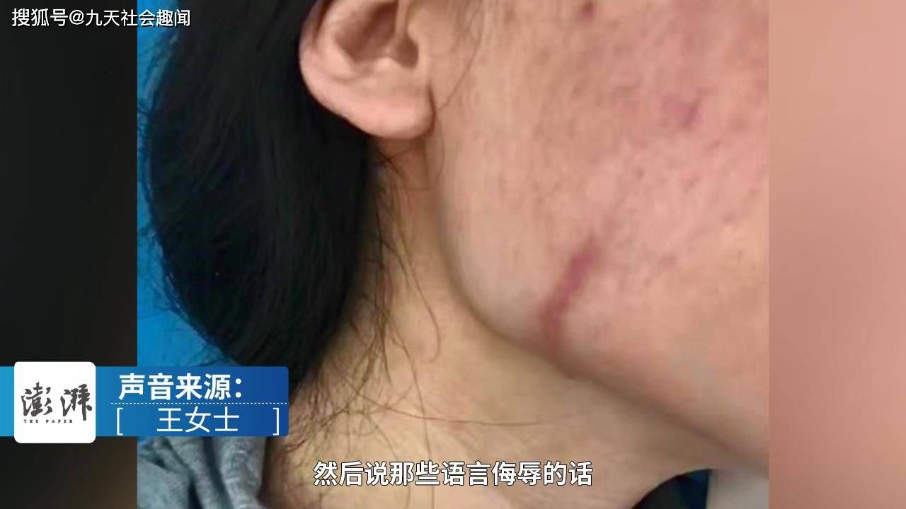 疤痕背后的故事与反被拉黑引发的深思，妊娠女子的劝诫与闺蜜的纠葛